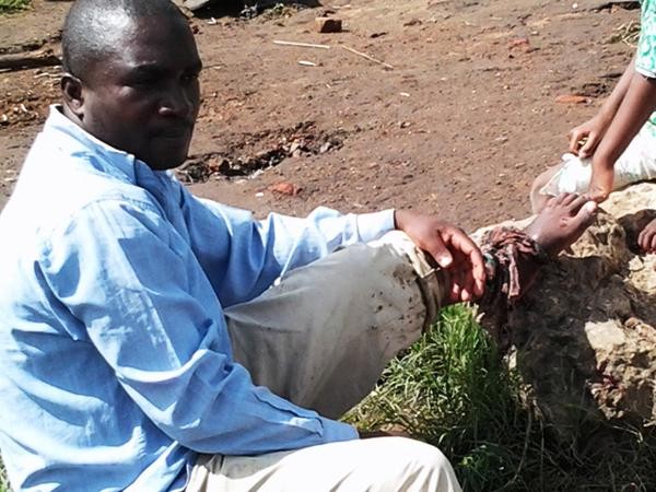 Samson Kakowa in Mulanje injured when trying to fix his destroyed maize mill (chigayo) Pic: Agnes Mizere